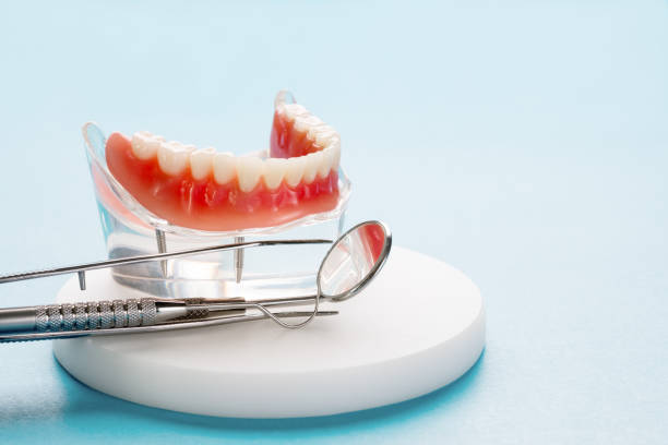 Full Mouth Reconstruction in Aberdeen, SD